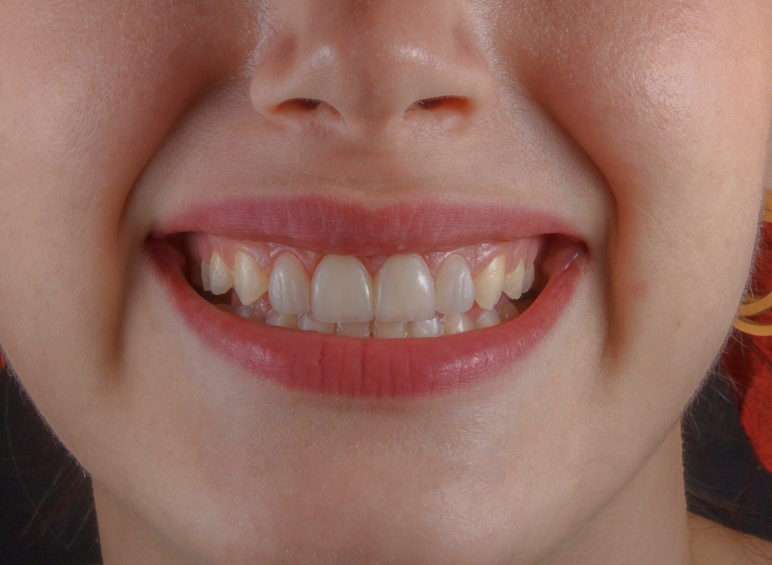 HelloTeeth Dental Care